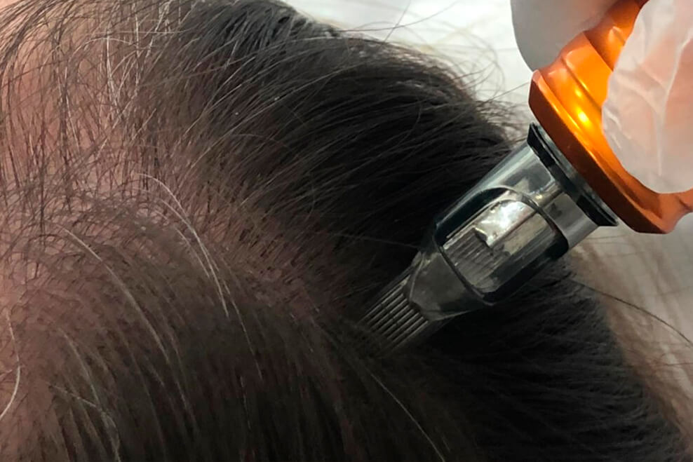 tricologia-em-vila-nova-conceição-sp