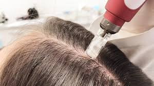 tricologia-em-vila-nova-conceição-sp