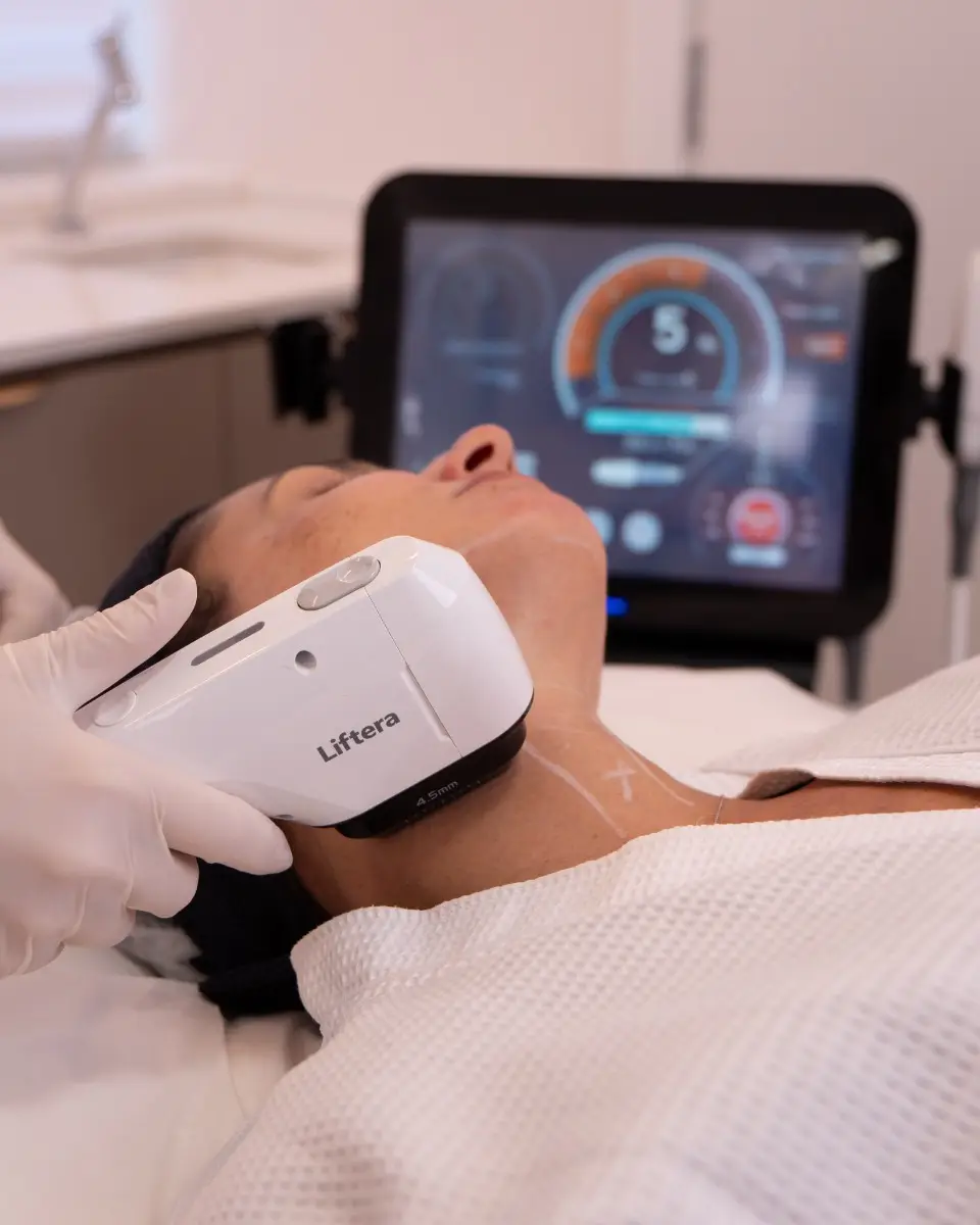 tratamento para flacidez facial e corporal em são paulo 003